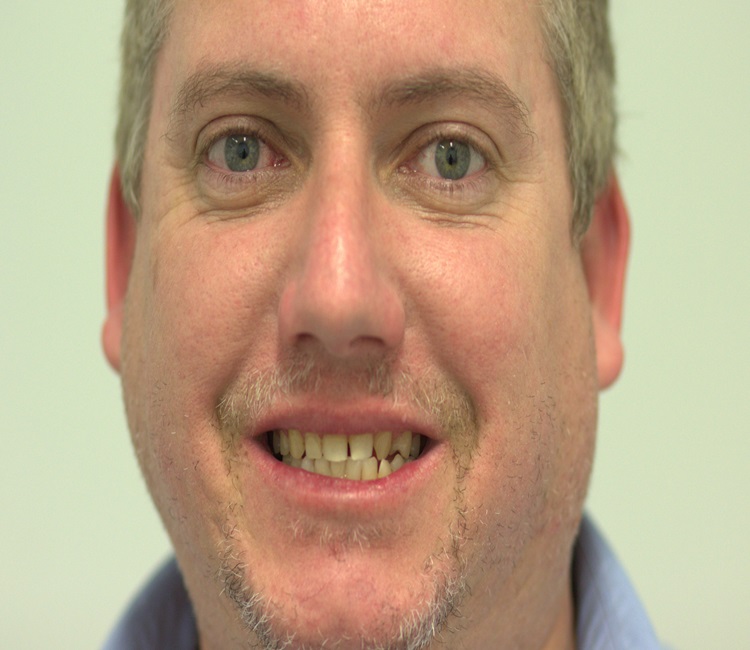 IMG_6738 – Copy IMG_6738 - Copy