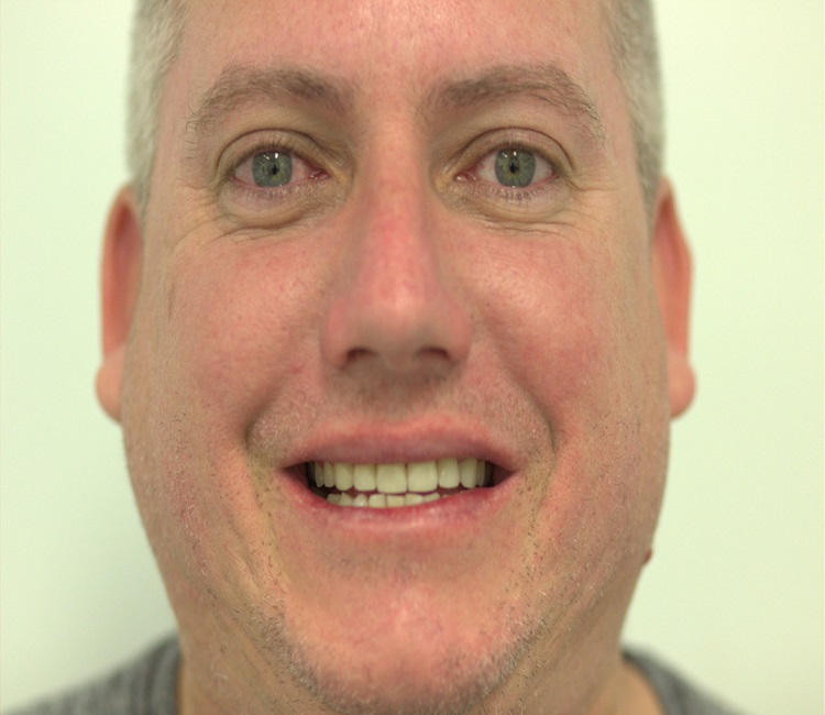 IMG_6818 – Copy IMG_6818 - Copy