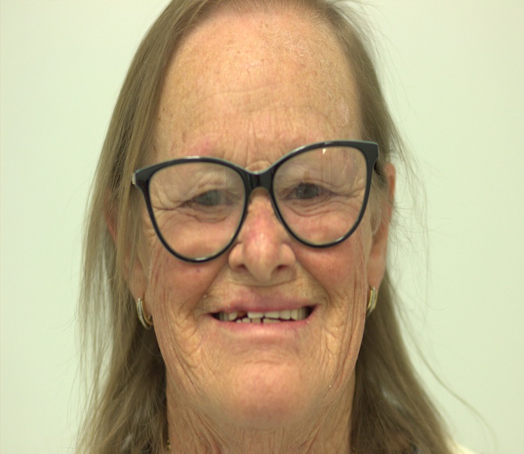 IMG_7318 – Copy IMG_7318 - Copy